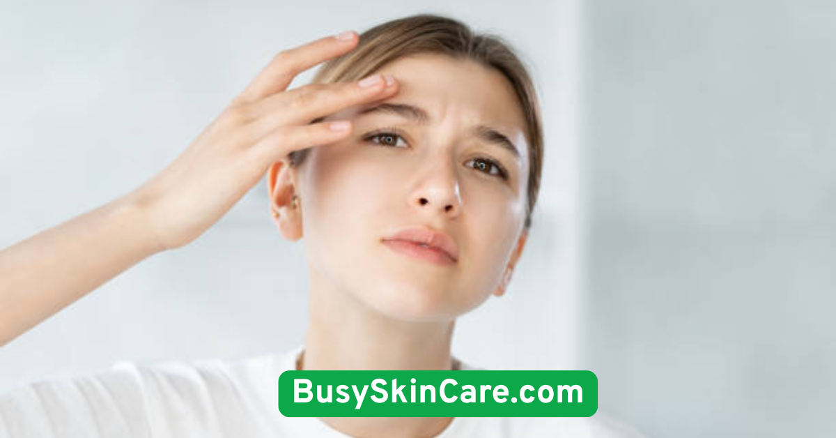 Minimize Stress to Prevent Breakouts