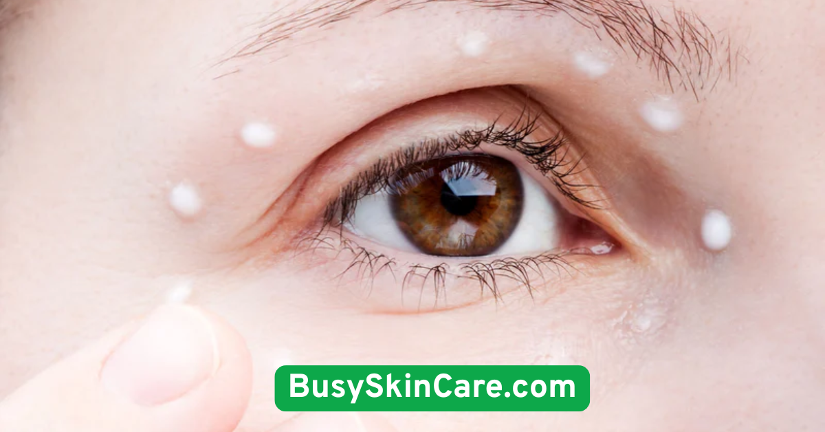 Don’t Skip the Eye Cream